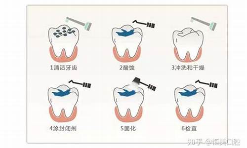 龋齿怎么读_龋齿怎么读 拼音